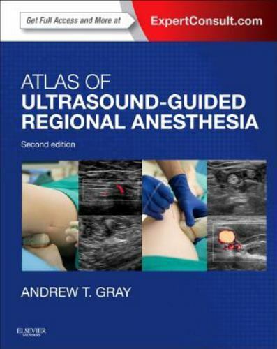 Atlas of Ultrasound-Guided Regional Anesthesia : Expert Consult - Online and...