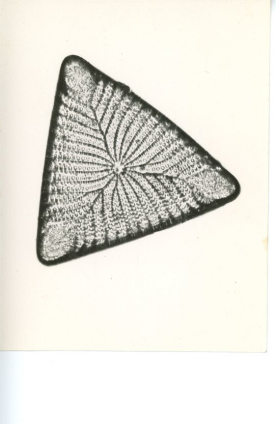 Vintage Triceratium Favus Silver Print Diatom, Les Bacillariophyta (Diatoms)