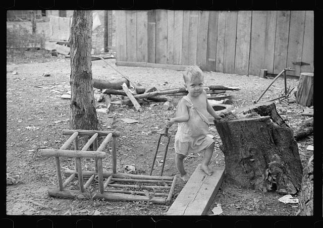 Child Suffering from Rickets & Malnutrition,Wilson Cotton Plantation,Arkansas,1