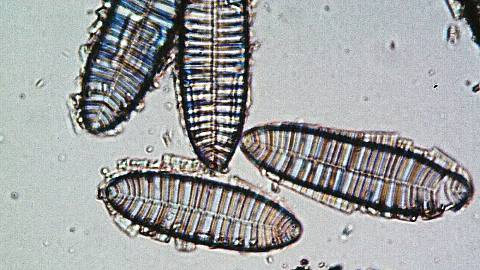  Antique Microscope Slide. Diatoms Suriella Gemma by W.Watson