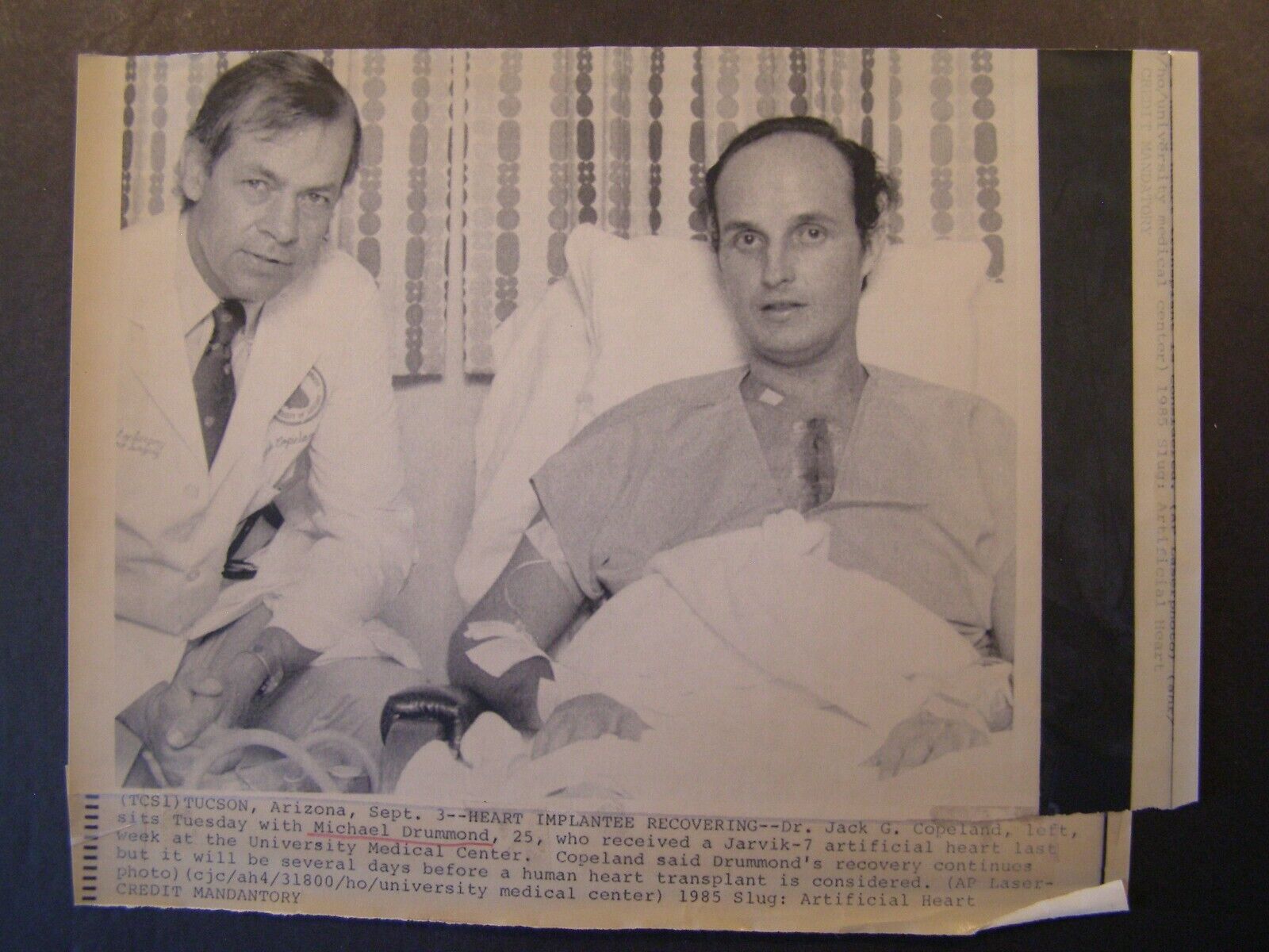 AP Wire Press Photo 1985 Artificial Heart Recipient Michael Drummond recovering 