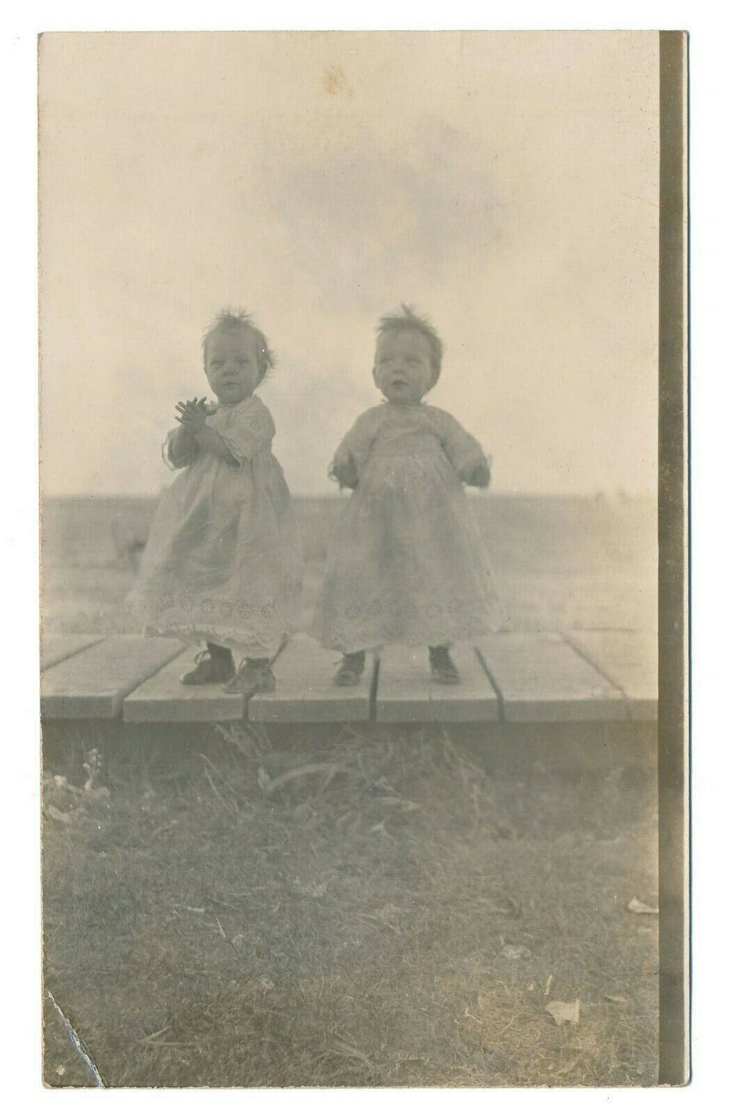 Toddler Twin With Birth Defect Arms Not Fully Formed Prairie Photo Postcard RPPC