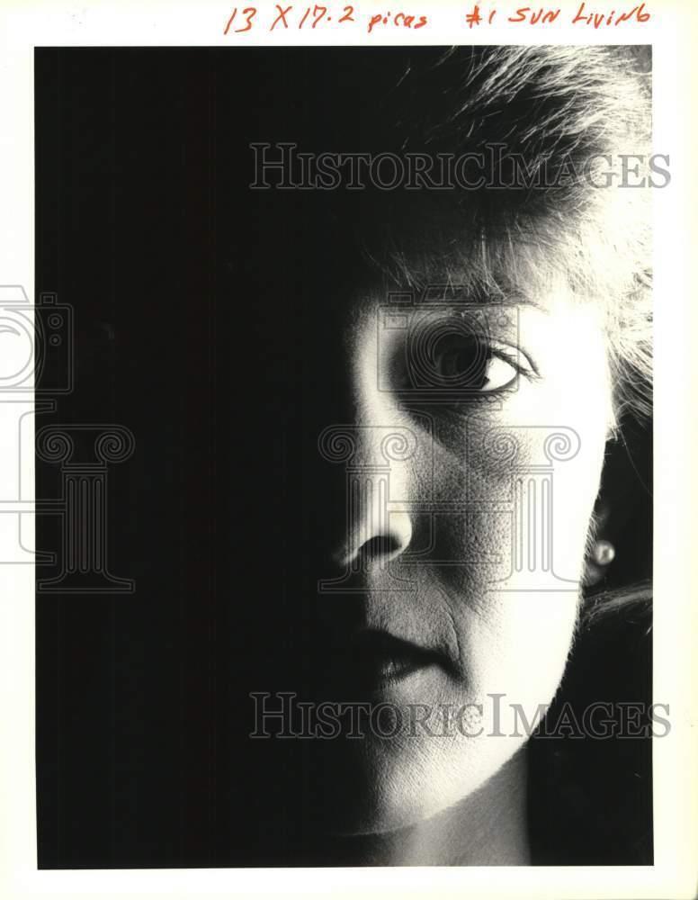 1991 Press Photo Tori Wessels suffers from porphyria, skin light sensitivity