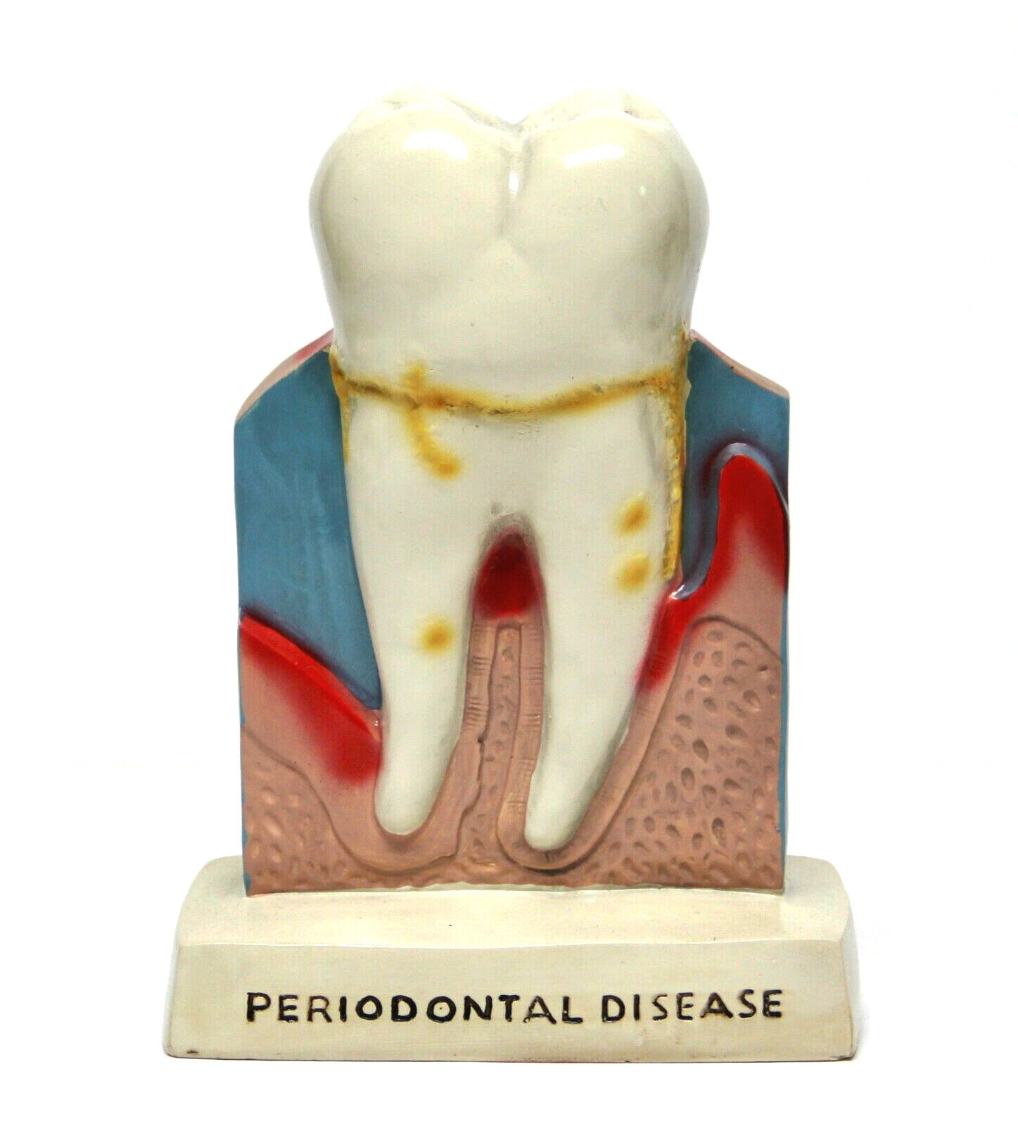 Dentist Dental Teeth Oral Anatomy Teaching Standing Decoration Model Figure