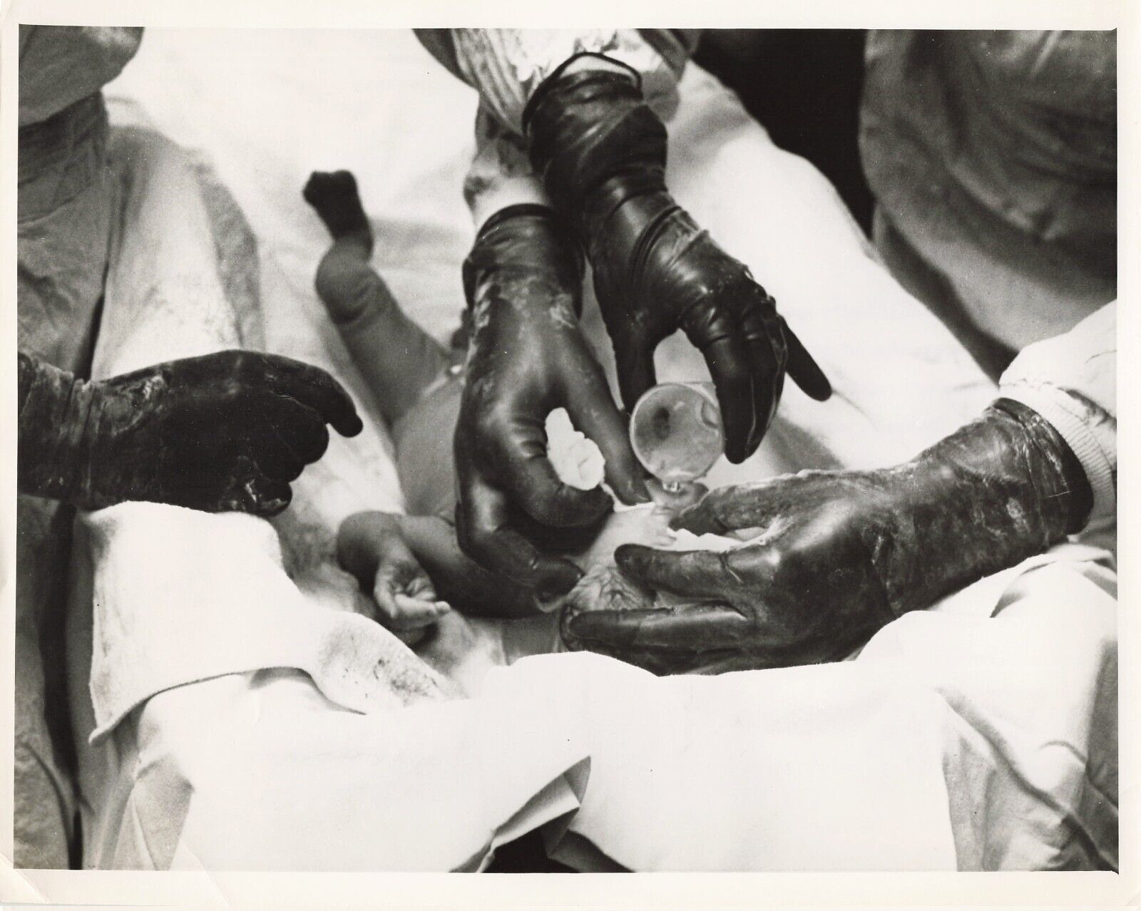 US Newborn Birth 1954 Press Photo Penicillin News Story Science Health  *P67b