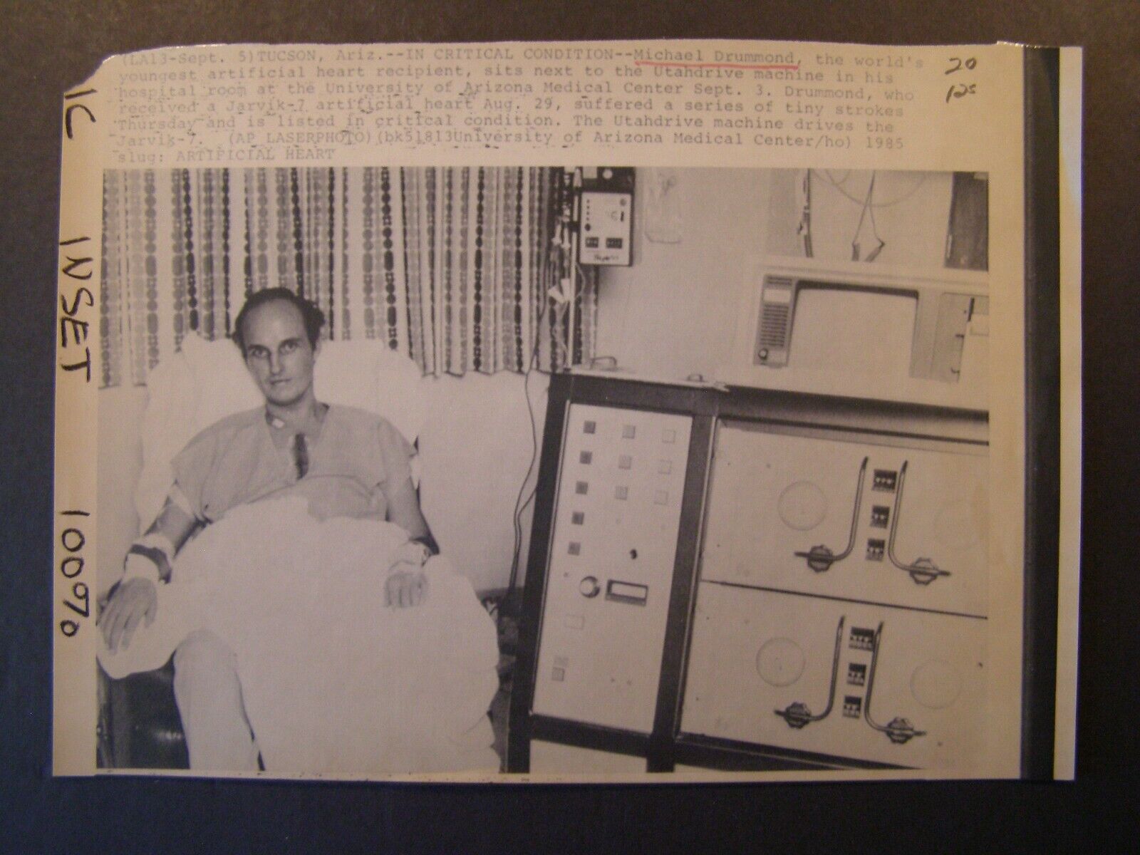 AP Wire Press Photo 1985 Artificial Heart Recipient Michael Drummond tiny stroke