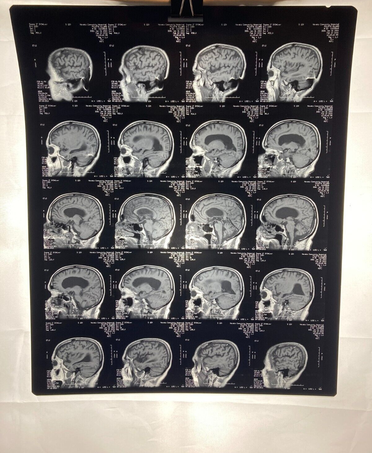 MRI CT Brain Scans X-Rays Medical Skull Prop Halloween Lot of 10 (A4)