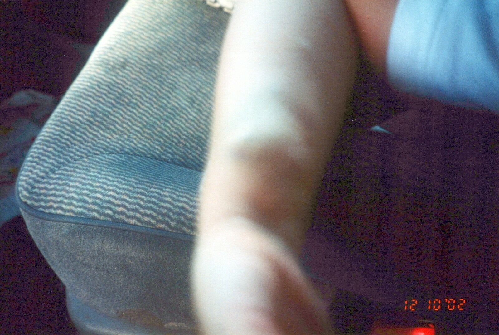 2000\'s Found Photo - Strange Weird Odd Picture Of Kids Arm With A Rash Disease