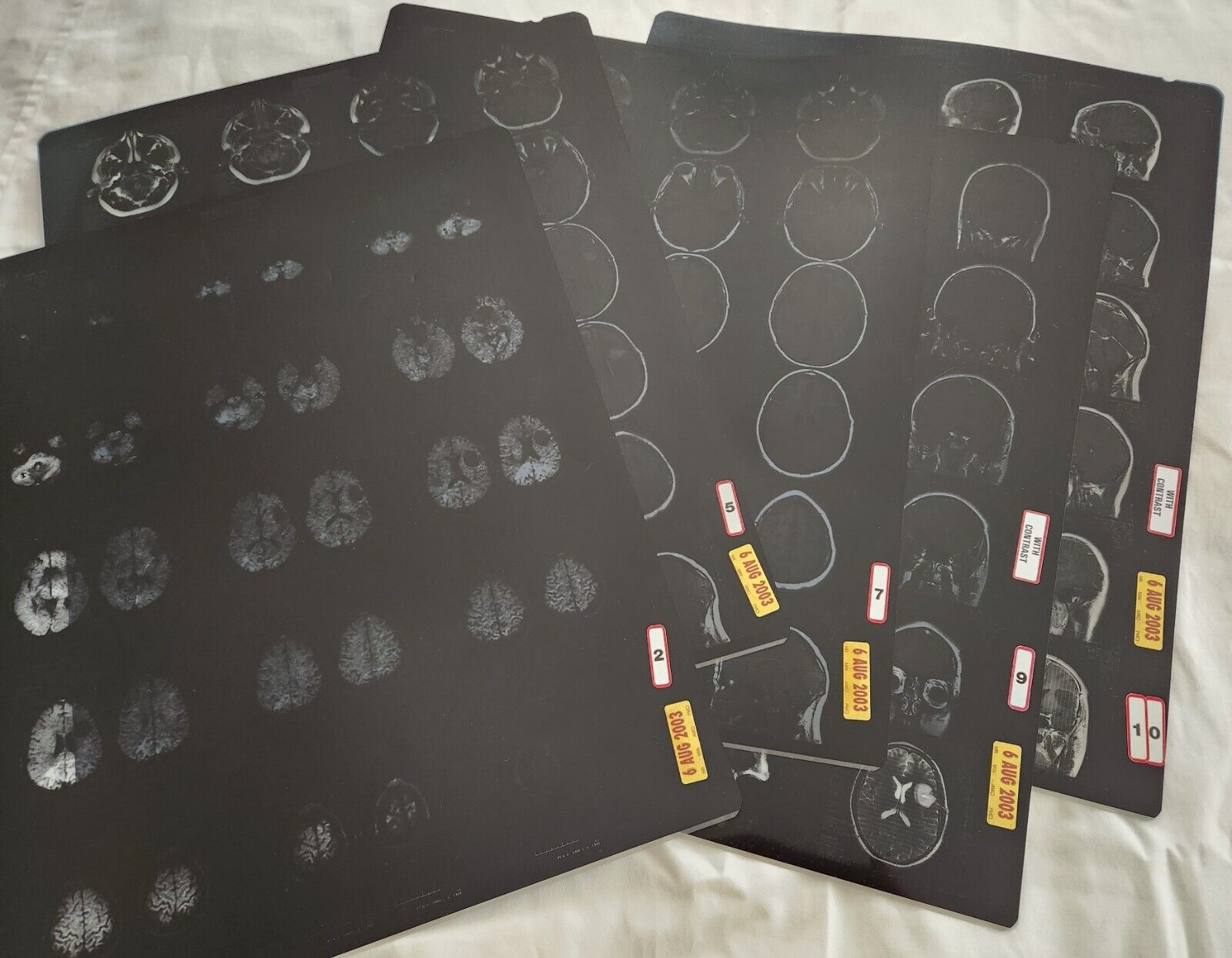 MRI, CT, X-Ray Brain Skull 6 Film Sheets 17