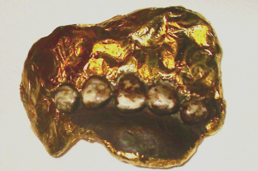 Bizarre Porcelain Teeth Wrapped in High Karat Solid 18K +Gold Foil Voodoo Occult