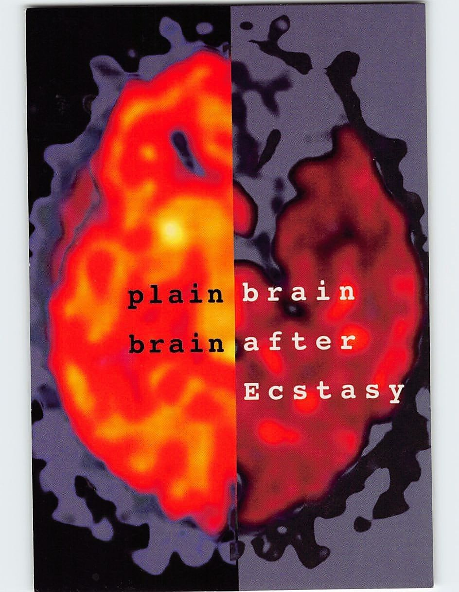 Postcard Brain Scans