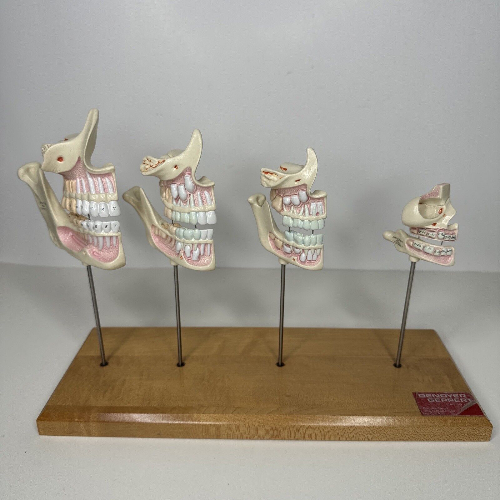 Vintage Denoyer-Geppert Teeth & Jaw Development Stages Model Anatomical Display