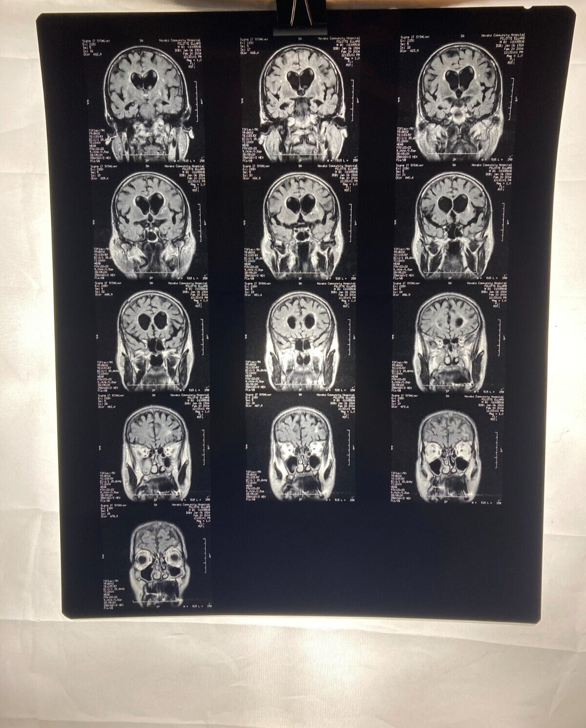 MRI CT Brain Scans X-Rays Medical Skull Prop Halloween Lot of 10 (A2)