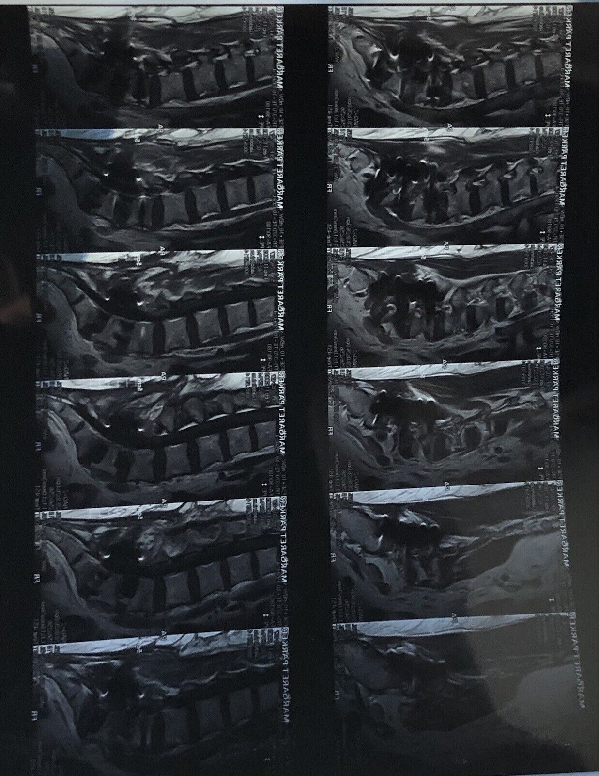 Lot of 6 X-Rays MRI 17\