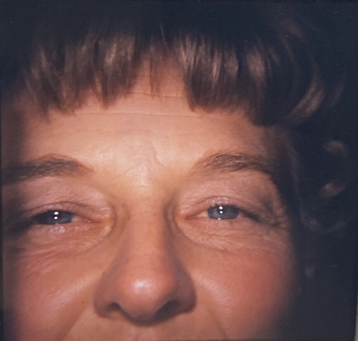 Vintage Photo Slide 1971 Woman Posed Pre-Eye Lift Operation
