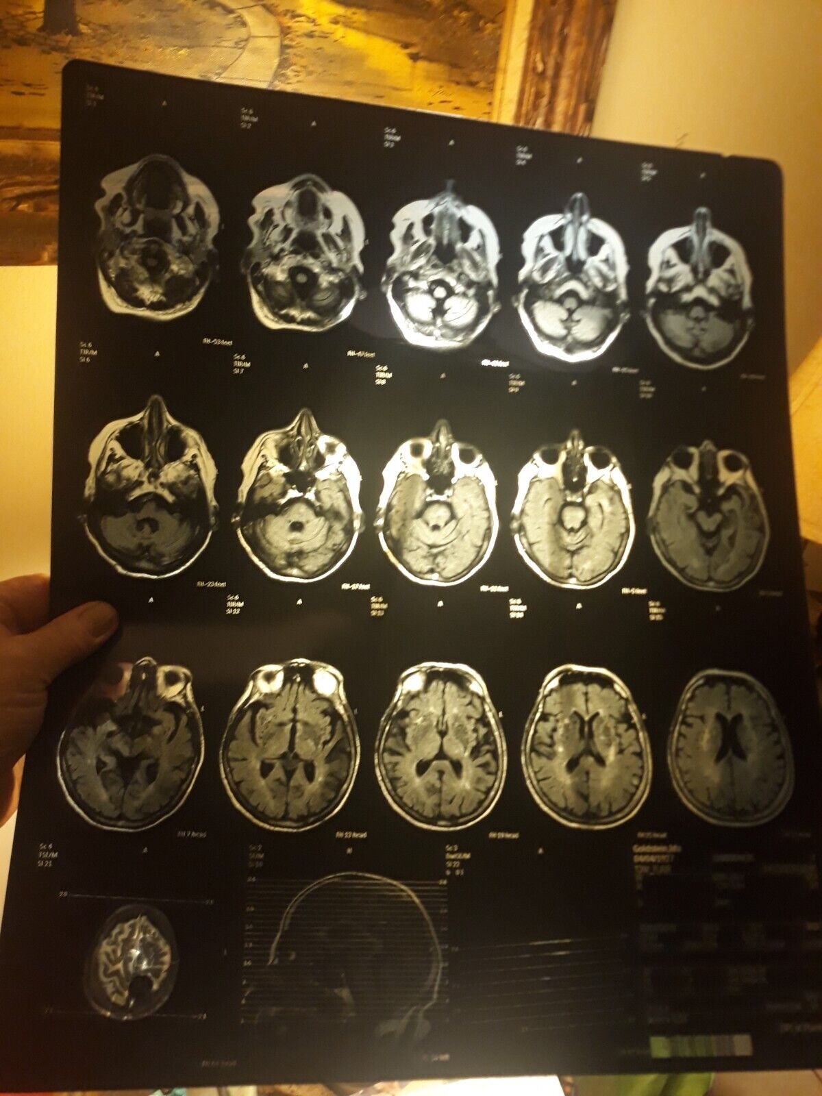 MRI  CT  SCANS  choice of one  14' by 17'  PAGES MEDICAL includes shipping