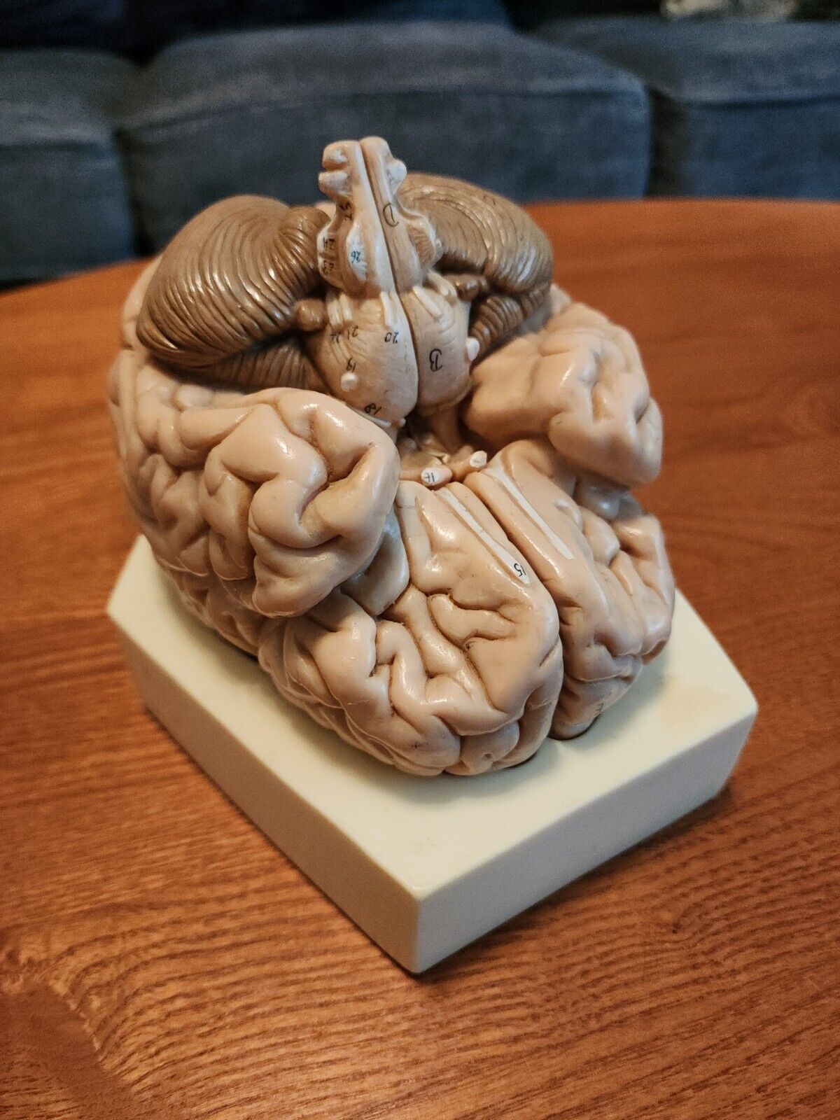 2-Part Brain Model Anatomy Model