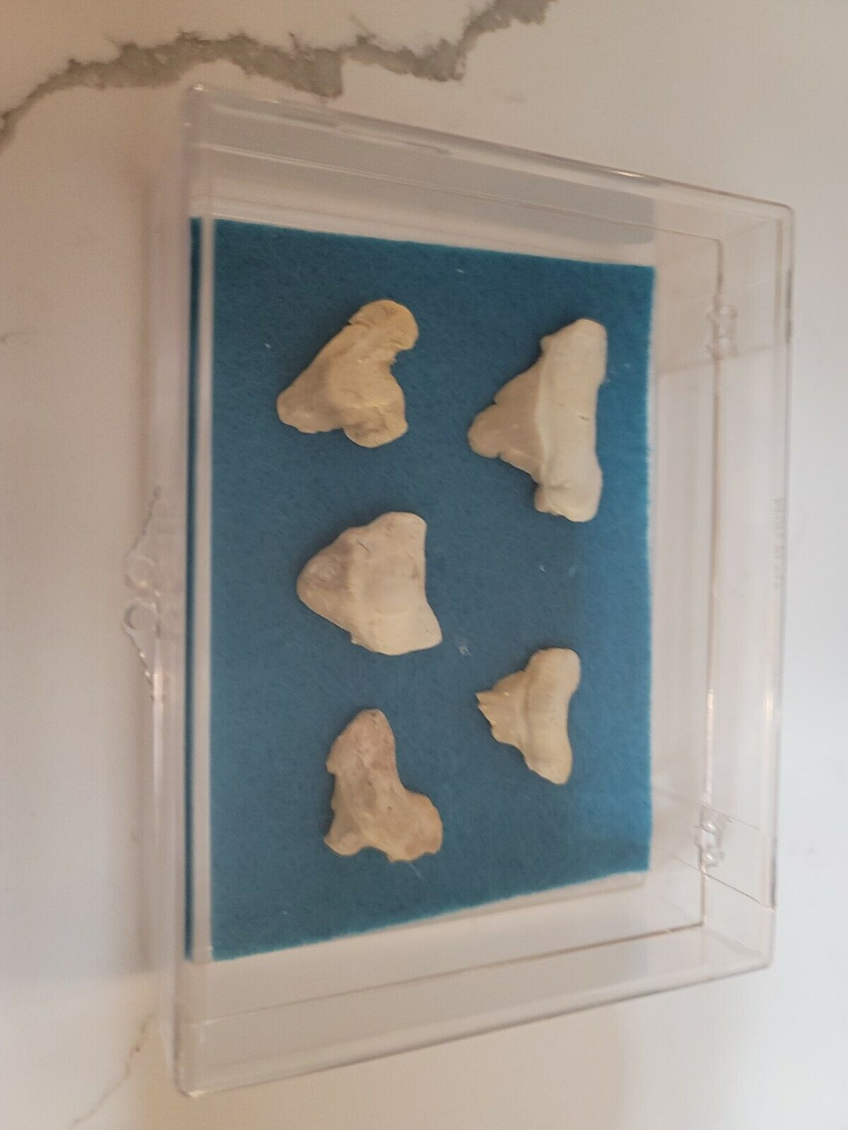 Very Rare Pathologically Deformed Otodus Obliquus Fossil Shark Teeth Set W/case