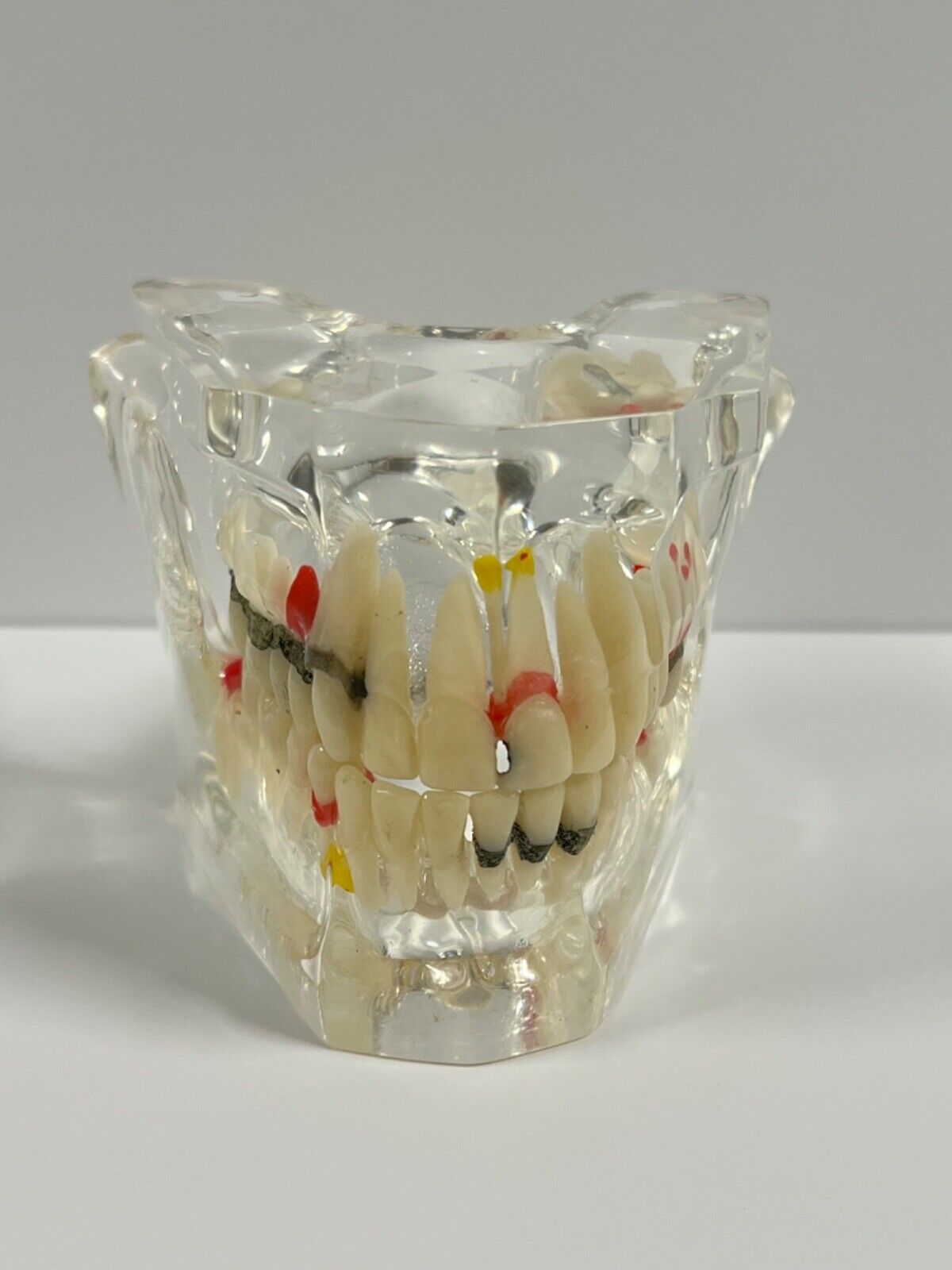 Dental Model; Upper & Lower Hinged Teeth; Used To Show Patients