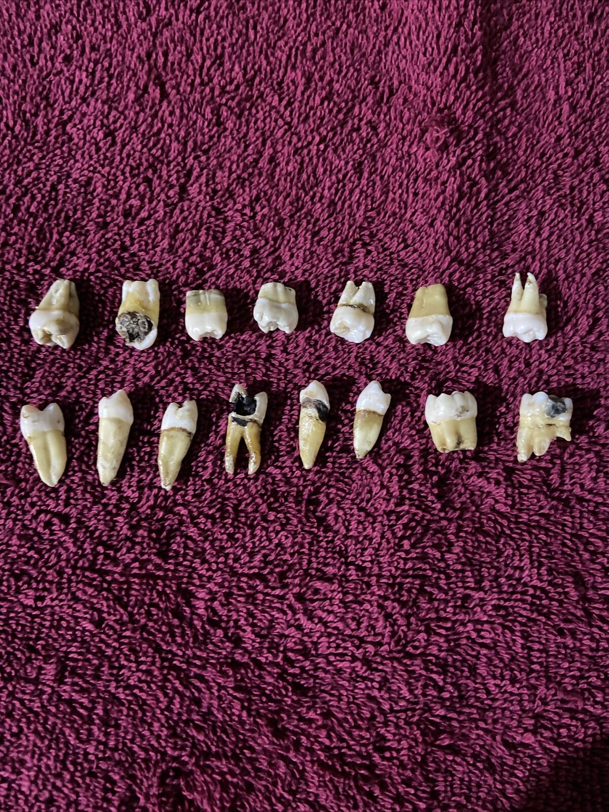 15 Human Teeth Extracted for Research and Dental Studies Molars Premolars