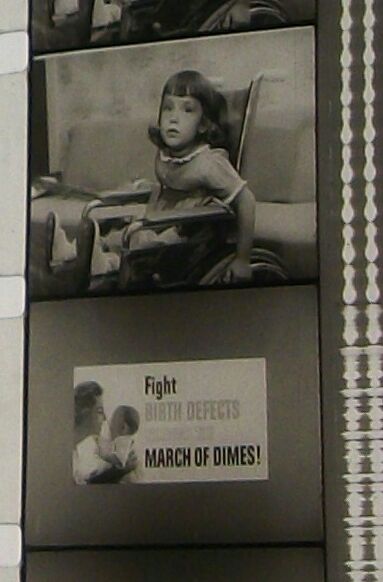 MARCH OF DIMES FIGHT BIRTH DEFECTS COMMERCIAL 16MM FILM MOVIE ON REEL H76