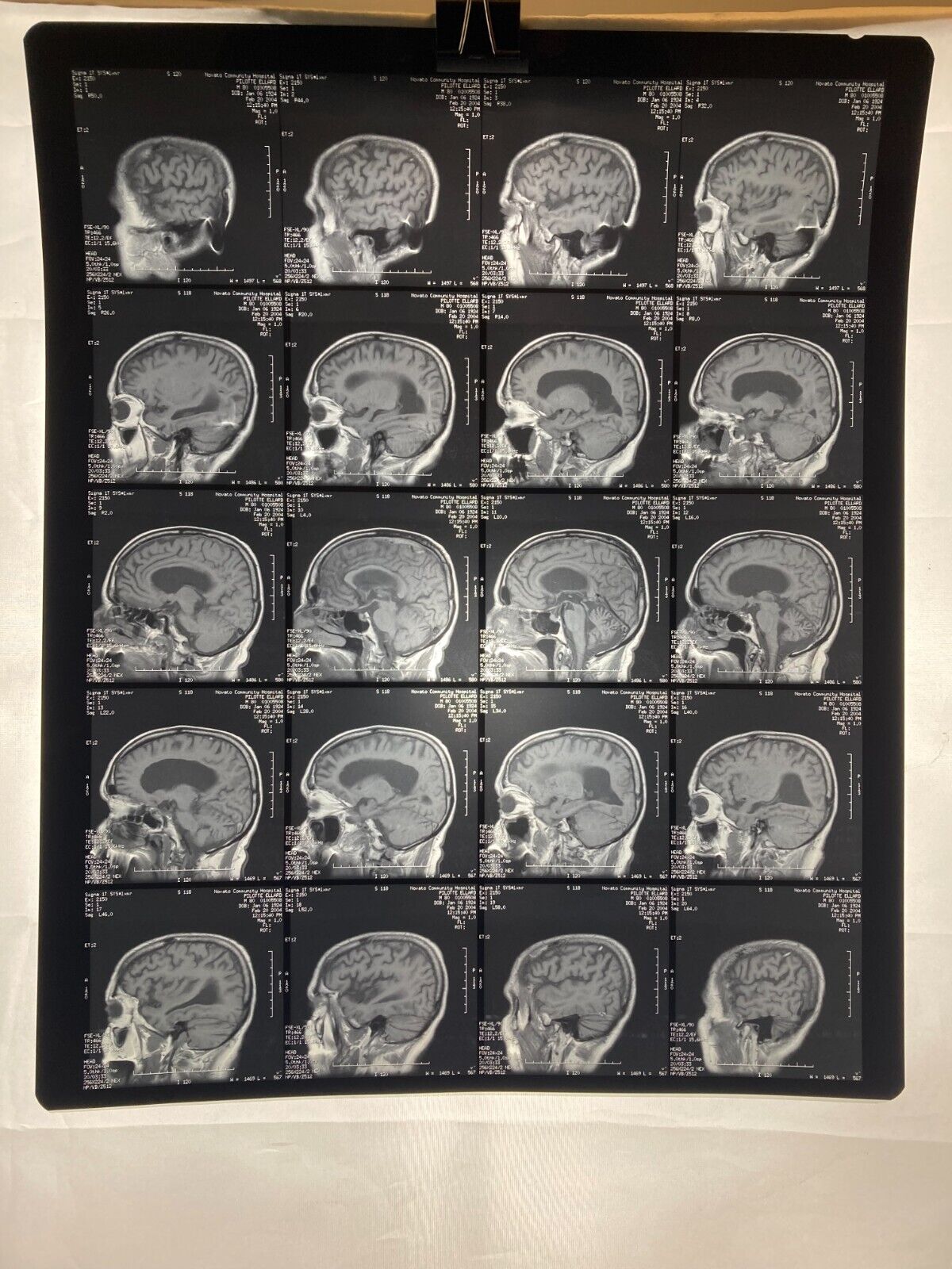 MRI CT Brain Scans X-Rays Medical Skull Prop Halloween Lot of 10 (A1)