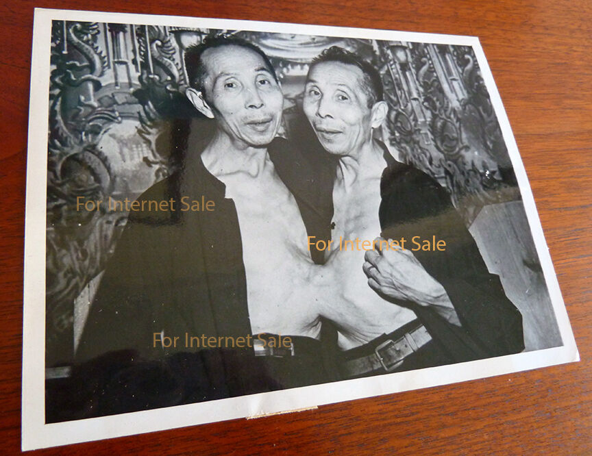 Ultra Rare 1948 Photo Chinese Siamese Conjoined Twins Nude Naked Circus, Medical