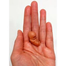 10 Weeks Baby Fetus, Stage of Fetal Development (Memorial/Miscarriage/Keepsake) picture