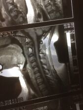 Real MRI 9 Prints Film Sheets Thoracic & Cervical Spine &  Shoulder Medical, Art picture