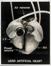 1976 Press Photo Artificial Heart from U.S.S.R. - hpa44725 picture