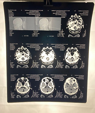 MRI CT Brain Scans X-Rays Medical Skull Prop Halloween Lot of 10 (A3) picture
