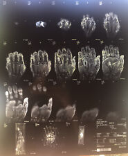 Lot Of 12 Real Right Hand MRI Films And Envelope 14” X 17” Art Or Medical Study picture