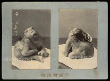 Very Rare Antique Medical Anatomical Photo Japan / Anatomy Oddities picture