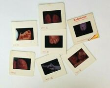Lot~ Hundreds Of VNTG Podiatrist Medical Slides~ Kodachrome Type~ Foot  & Ankle  picture