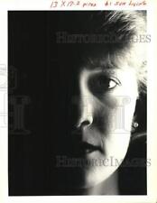 1991 Press Photo Tori Wessels suffers from porphyria, skin light sensitivity picture