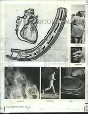 1971 Press Photo Health - Study of How to Die of a Heart Attack - nob33716 picture
