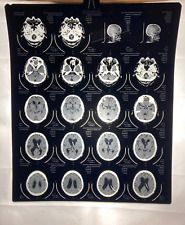 MRI CT Brain Scans X-Rays Medical Skull Prop Halloween Lot of 6 (A6) picture
