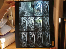 MRI Film Cervical Lumbar Neck Back Images 12 Sheets  14