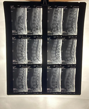MRI CT Spine Scans X-Rays Medical Back Prop Halloween Lot of 3 (A7) picture