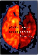 Postcard: Brain Scans - Effects of Ecstasy (XTC, MDMA) Drug Abuse on Seroto A168 picture