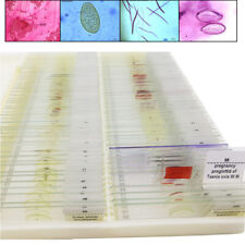 100Pcs Medical Parasite Microscope Parasitology Prepared Slides picture