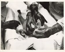 US Newborn Birth 1954 Press Photo Penicillin News Story Science Health  *P67b picture