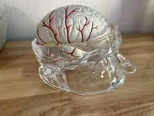 Seroquel Medical Pharmaceutical Brain Head Display Schizophrenia picture