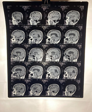 MRI CT Brain Scans X-Rays Medical Skull Prop Halloween Lot of 10 (A4) picture