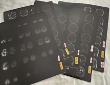 MRI, CT, X-Ray Brain Skull 5 Film Sheets 17