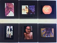 Vtg Lot 100 35MM Slides Medical Pathology Respiratory Disease x-rays graphic picture