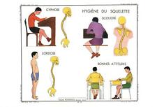 BAD POSTURES POSTCARD - FRENCH LANGUAGE - HYGIENE DU SQUELETTE - NEW & PERFECT picture