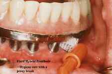 Dental Teeth TOOTH IMPLANT MAINTENANCE And REPAIR PowerPoint Presentation on CD  picture