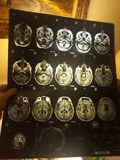 MRI  CT  SCANS  choice of one  14' by 17'  PAGES MEDICAL includes shipping picture