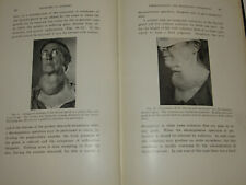 1928 'PROBLEMS IN SURGERY' BOOK GEORGE W CRILE, MD 49 ILLUSTRATIONS LECTURES picture